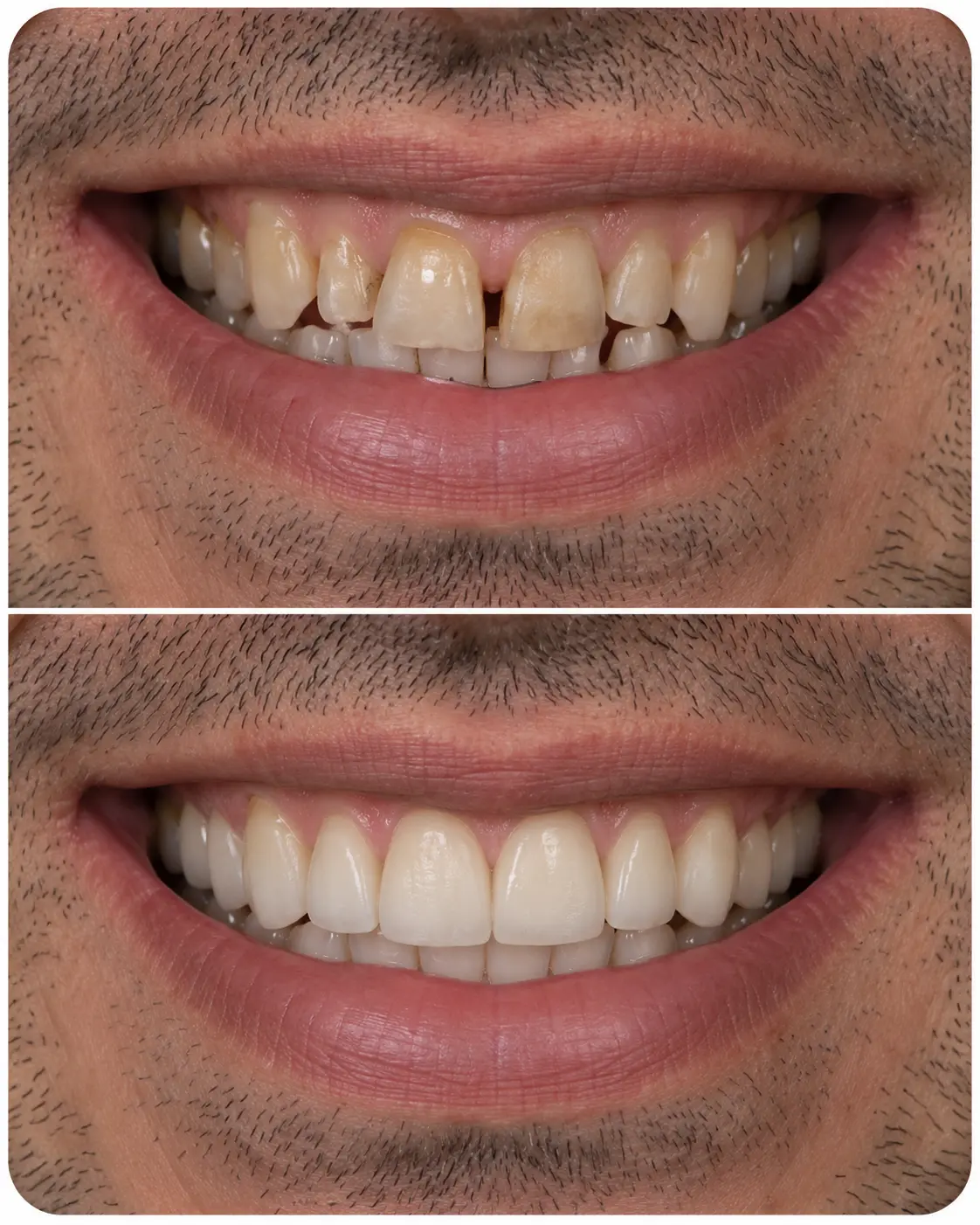 Caso real com imagens de antes e depois de um sorriso